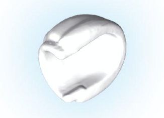 Playmobil - 30092350 - Puff sleeve