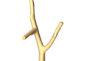 Playmobil - 30209972 - Forked branch 62 3 branch
