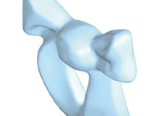 Playmobil - 30256510 - Strauss bow